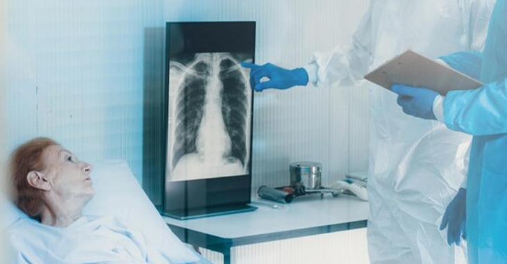 The role of verbal autopsy in deciphering tuberculosis deaths in India