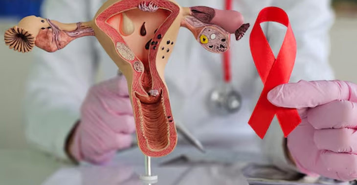 One woman dies in every 2 minutes from preventable cervical cancer